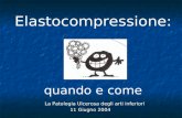 La Patologia Ulcerosa degli arti inferiori 11 Giugno 2004 Elastocompressione: quando e come.