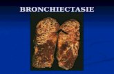 BRONCHIECTASIE. Dilatazioni anormali e permanenti dei rami bronchiali, conseguenti ad rami bronchiali, conseguenti ad alterazioni della struttura delle.