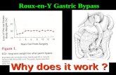 Roux-en-Y Gastric Bypass Why does it work ? NON RESTRITTIVO PURO NON RESTRITTIVO PURO NON MALASSORBITIVO NON MALASSORBITIVO ???? TERZA VIA ???? ????