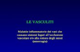 LE VASCULITI Malattie infiammatorie dei vasi che causano sintomi legati allocclusione vascolare e/o alla rottura degli stessi (emorragia)
