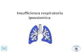 Insufficienza respiratoria ipossiemica. Lefficacia della ventilazione meccanica nellinsufficienza respiratoria ipossiemica è spesso parziale.