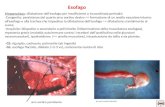 Esofago Megaesofago: dilatazione dellesofago per insufficiente o incoordinata peristalsi -Congenito: persistenza del quarto arco aortico destro => formazione.