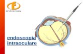 Endoscopia intraoculare. Microscopio VISIONE ENDOSCOPICA VIA LIMBUS E ORA SERRATA VISIONE ENDOSCOPICA VIA LIMBUS E ORA SERRATA Sistema ingrandente no