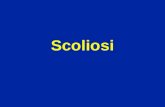 Scoliosi. La scoliosi é una curvatura vertebrale strutturata che non sparisce quando si corregge linclinazione del bacino nè quando il soggetto si flette.