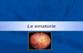 Le ematurie. Ematuria L’ematuria è un sintomo e non una malattia ed il suo inquadramento diagnostico non è esclusivamente di pertinenza urologica.