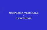 Neoplasia vescicale