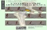 artroprotesi d'anca