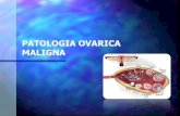 Patologia maligna de ovario