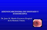 Adenocarcinoma De Esofago Y Endoscopia