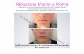 Riduzione Del Mento a Roma | Dr. Rauso