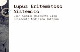 Lupus Eritematoso  Sistemico