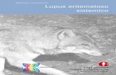 Lupus eritematoso_It361_contenuto_low_012012