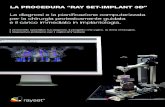 Manuale ray set implant 3d
