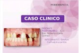 Caso Clinico Periodoncia (Maria)