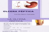 Ulcera Peptica Expo