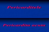 C15 - Pericardite