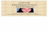 Lupus Eritemaoso Sistemico 2