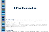 3   Rubeola