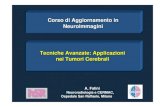 Tecniche Avanzate: Applicazioni nei Tumori Cerebrali Corso di ...