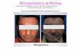 Rinoplastica Roma | Chirurgo Plastico Raffaele Rauso