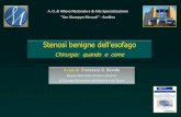 “San Giuseppe Moscati” - Avellino Medici/Stenosi... · • Reflusso gastro – esofageo ... Reflusso Esofago cervicale 1 +++ Reflusso ... Caso clinico • Uomo di 50 anni, ...