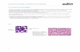 Modulo 1 - LH - Epidemiologia e diagnosiecmclub.org/wp-content/uploads/2018/02/Modulo-1-LH-Epide...Slide 1 Normal lymphocyte Reed-Sternberg Cell con aspetto a "pop corn" Il Linfoma