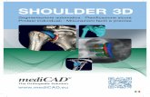 SHOULDER 3D - hectec.de · (p. es. componente glenoidea e stelo). ... configuratore impianti permette di selezionare tra diverse protesi della spalla. ... sono difficili da immaginare