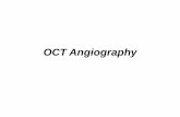 OCT Angiography: The Newest Frontier for the … ·  · 2018-02-13come vasi anomali nella retina esterna (e.g.: CNV in AMD) Il Significato del Segnale nelle immagini AngioVue . OCT-A
