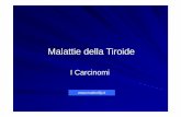 35 - Malattie della Tiroide - I Carcinomi [modalità … - Malattie della Tiroide - I...Carcinoma papillare con metastasi linfonodi latero-cervicali in struma tiroideo Tiroidectomia