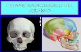 L’ESAME RADIOLOGICO DEL CRANIOetsrm.it/doc_rubriche/231-002-03_Rx_cranio.pdf · •Indicazioni: studio dei seni paranasali, studio delle orbite. • Posizione del paziente: paziente