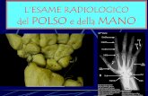 L’ESAME RADIOLOGICO del POLSO MANO - etsrm.it · •Indicazioni: in traumatologia, per lo studio del versante radiale del carpo (stiloide radiale e scafoide carpale). • Posizione