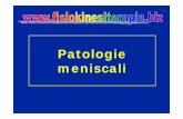 Patologie meniscali - fisiokinesiterapia.biz · Mobilità dei menischi IL menisco esterno avanza in estensione e arretra in flessione IL menisco interno è meno mobile