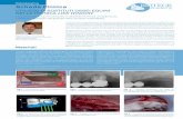 Odontoiatria Scheda Clinica - bioteckacademy.com · equino composto di una miscela 1:1 di granuli spongiosi e corticali, del diametro di 0,5-1 mm (Osteoxenon, Bioteck). L’innesto