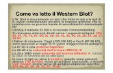 Il W. Blot è sicuramente un test che titola le IgG e le ...omeoweb.com/documenti/biblioteca/HP-diapo.pdf · le Ig sieriche si estende fino alle proteine con 60 kD di peso (riferite