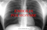 Embolia polmonare - sdc858063671d84c6.jimcontent.com · Si definisce embolia polmonare, o meglio tromboembolia polmonare, una condizione ... -risposta fisiologia alterata all’ attività(respiro