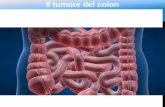 Il tumore del colon - UNI3IBLIOS tumore del colon e il terzo tumore più frequente 4000 Persone sono colpite ogni anno in Svizzera 11% del insieme dei tumori nei due sessi Circa 1600