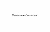 Carcinoma Prostatico - ilte-cml.org · Carcinoma della prostata La cellula neoplastica del carcinoma prostatico origina dall’epitelio prostatico Le cellule trasformate possono mantenere