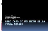 Raro caso di melanoma della fossa nasale · PDF fileRARO CASO DI MELANOMA DELLA FOSSA NASALE Ospedale di Pistoia U.O. di Otorinolaringoiatria Dott. Gabriele Borri