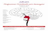 Perfusione Cerebrale per Immagini - ainr.it · • 16:40 - 17:00 Proposta di standardizzazione di protocolli RM di perfusione cerebrale con mdc * Principi fisici, tecniche di acquisizione,