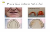 Protesi totale metodica Prof.Gerber - VZ odontotecnica ... · Protesi totale metodica Prof.Gerber Situazione iniziale Protesi attuali in bocca Modello studio superiore Modello studio