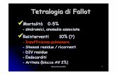 Tetralogia di Fallot - omceomb.it · DIV Coartazione Ostruzione all’uscita VS Anomalie coronariche origine tragitto Monza, 23 marzo 2013 7. Transposizione ... fisiopatologia Monza,