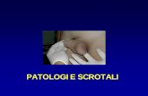 PATOLOGIE SCROTALI - calcom.it patologie dello Scroto... · esame obiettivo: ispezione e palpazione della radice dello scroto in clinostatismo ed ortostatismo, in condizioni di riposo