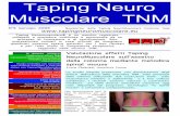Taping Neuro Muscolare TNM - corsifisioterapia.com · palpazione e "sensazione di freddo". I passaggi posturali e i trasferimenti avvenivano con minimo aiuto, la statica eretta in