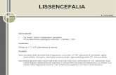 LISSENCEFALIA - asmn.re.it club 11aprile2017... · delle anomalie delle anomalie della migrazione neuronale (4°-20° settimana di vita fetale): agiria, lissencefalia, microgiria,