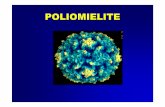 Poliomielite Didattico/Malattie...• Reversione del ceppo vaccinale a polio selvaggio (mutazione genomica nella regione 5’ non codificante) e riacquisizione della neurovirulenza