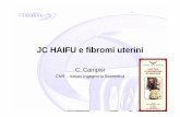 JC HAIFU e fibromi uterini - Home - Endometriosi · • Il riassorbimento del mioma è lento e gli effetti ... Microsoft PowerPoint - Fibroma dell'utero, infertilità e Haifu.ppt