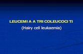 LEUCEMIA A TRICOLEUCOCITI - campus.unibo.itcampus.unibo.it/85279/8/Bacci_hcl 2012.pdf · Leucemia a tricoleucociti (LTL) 2% dei LNH-B periferici, età mediana 55 anni rapporto M/F=5:1