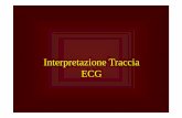 Interpretazione Traccia ECG - Ordine dei Medici Chirurghi ... · ECG IntervalloSS--TT •• Segmento ST: definito dal termine del QRS all’inizio onda T. •• Non deve deviare