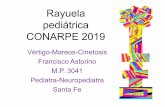 ASTORINO - Rayuela pediátrica 2019...desplaza lateralmente al lado hipovalente. • Otoscopía : tanto de pabellón como de membrana, descartando inflamación, infección o malformaciones.