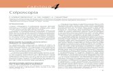 Colposcopia - Verduci · 27 CAPITOLO Colposcopia F. SOPRACORDEVOLE1, A. DEL FABRO1, A. CIAVATTINI 2 1Dipartimento di Ginecologia Oncologica Centro di Riferimento Oncologico Aviano